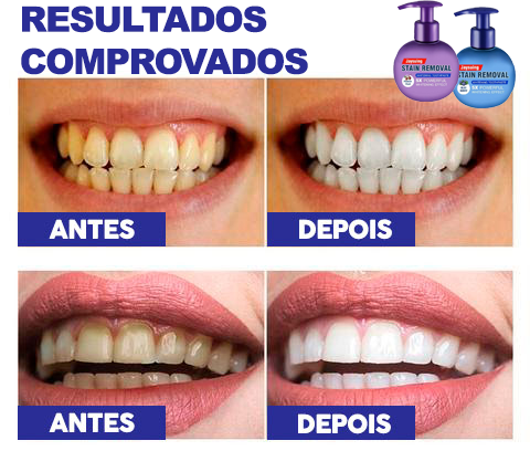 Clareador WhitePlus® - Exclusiva tecnologia